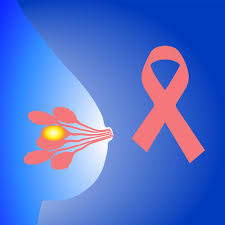 Best Medical Oncologist In Bangalore For Breast Cancer